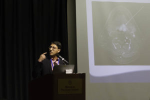 Dr. Khan illustrates an apparent cancer cure with LDN.