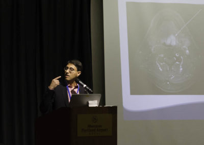 Dr. Khan illustrates an apparent cancer cure with LDN.